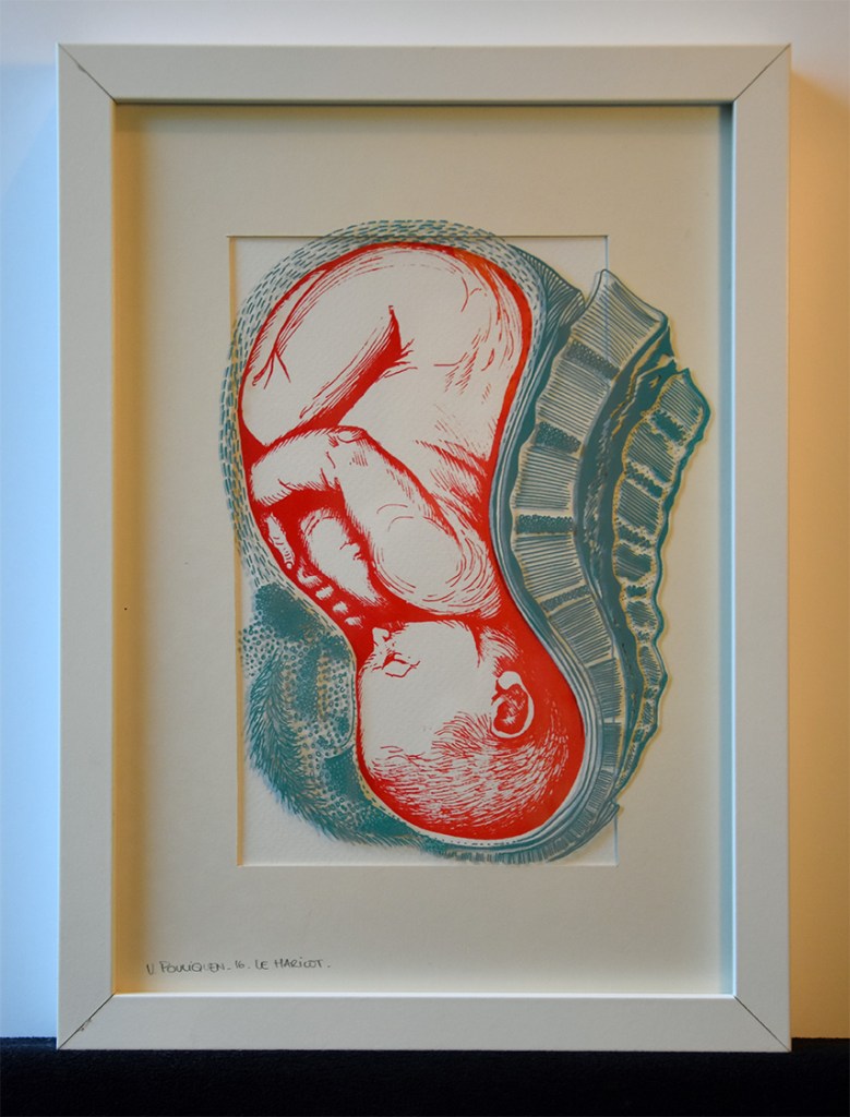 V POULIQUEN_Le Haricot, sérigraphie bichromie sur papier et verre, 21x30cm, juin 2016